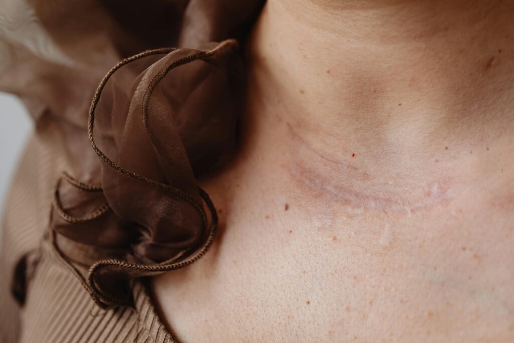 Close-up image of a neck scar with surrounding delicate brown fabric, highlighting skin texture and detail.